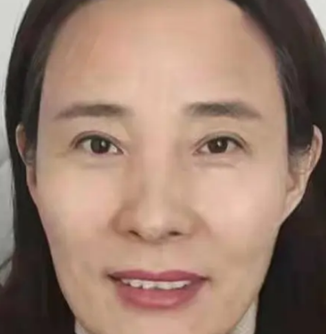 自体脂肪胶