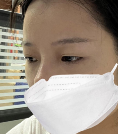 自体脂肪胶