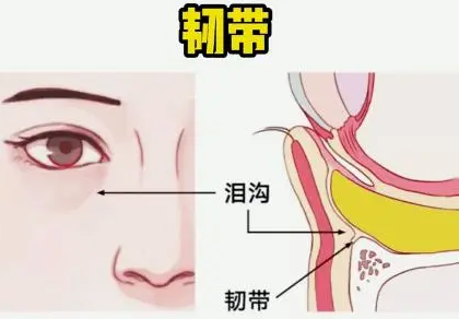 自体脂肪胶