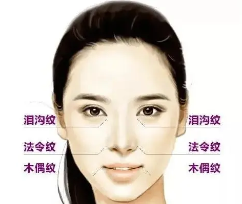 自体脂肪胶