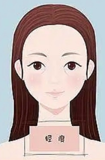 泪沟填充