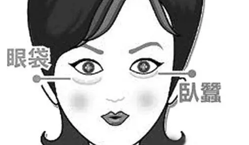 泪沟填充