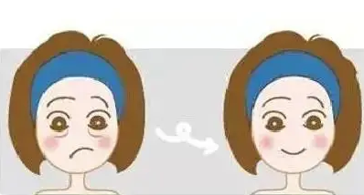 泪沟