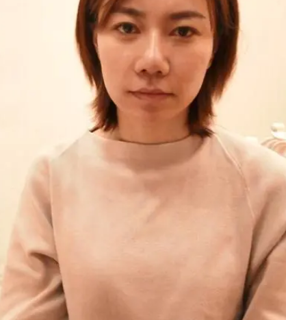 自体脂肪丰胸