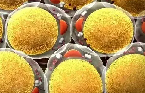 自体脂肪丰胸