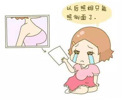 自体脂肪丰胸