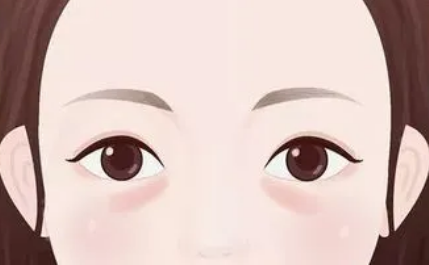 自体脂肪丰胸