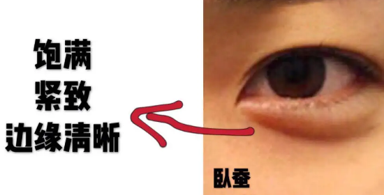 眼袋