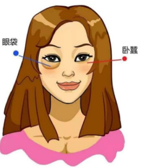 眼袋