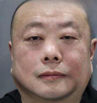 去眼袋手术
