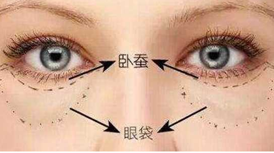眼袋