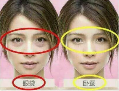 眼袋