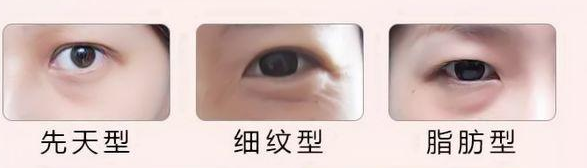 眼袋