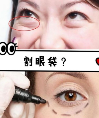 眼袋