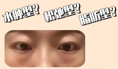 眼袋
