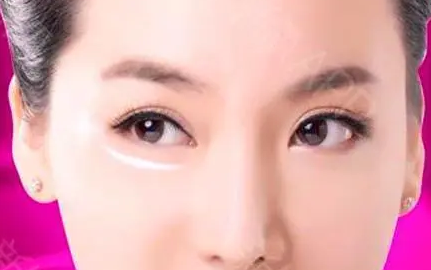 去眼袋手术