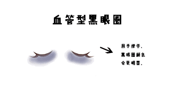 去眼袋手术