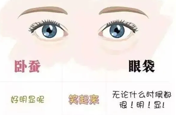 去眼袋手术