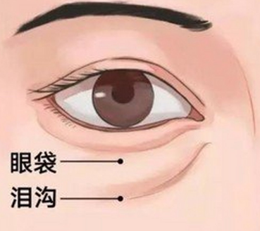 泪沟