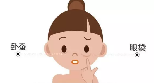 去眼袋手术