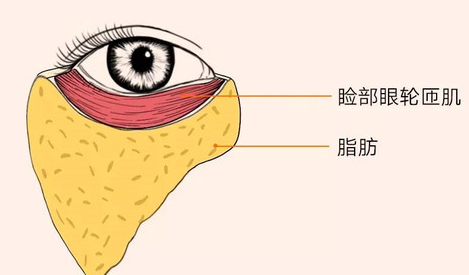 去眼袋手术