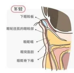 去眼袋手术