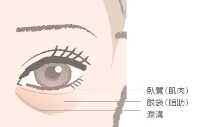 去眼袋手术