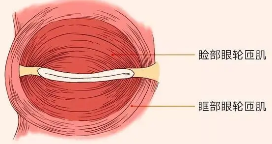 泪沟填充