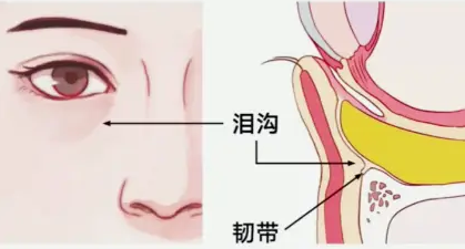 泪沟填充