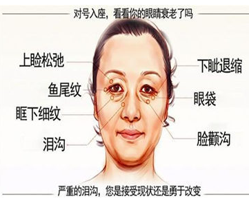 泪沟填充