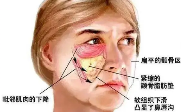 去眼袋手术