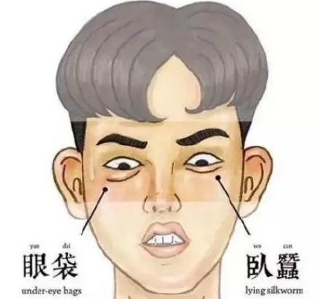 去眼袋手术