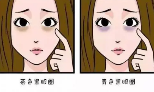 泪沟填充