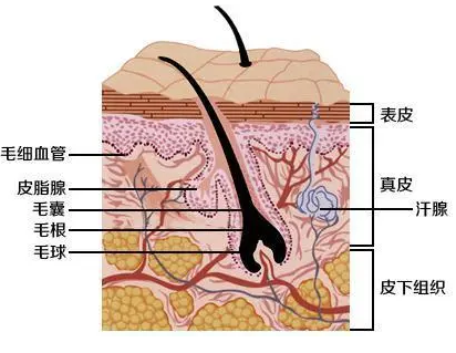 雀斑