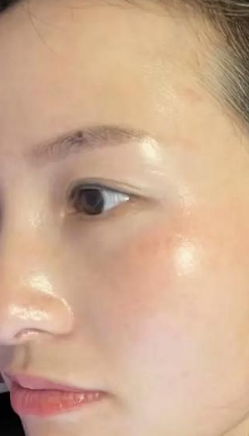 皮肤