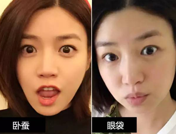 眼袋