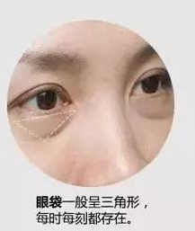 眼袋