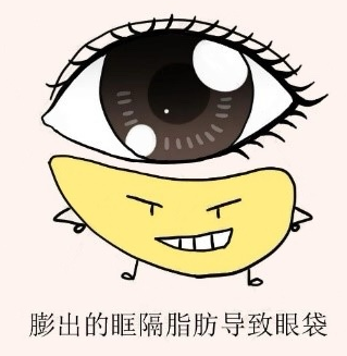 眼袋