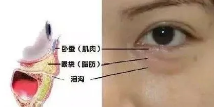 眼袋
