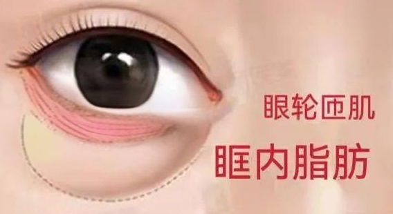 眼袋手术