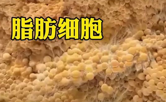 自体脂肪填充