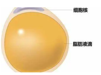 自体脂肪填充