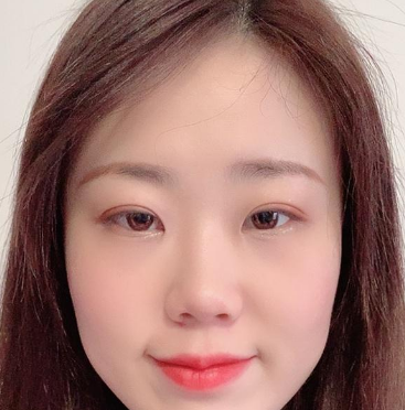 眼袋
