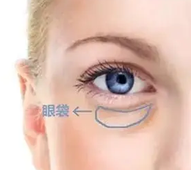 眼袋