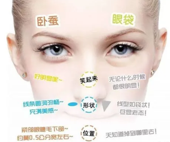 眼袋