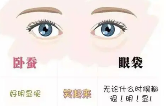 去眼袋手术