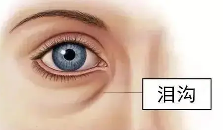 眼袋手术