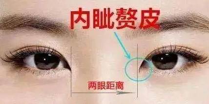双眼皮