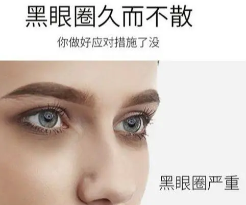 眼袋