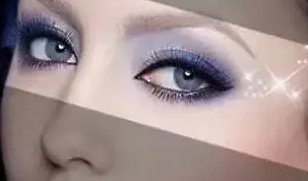 眼袋手术